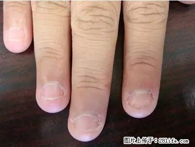 剪指甲、挖耳屎,这些日常小动作竟隐藏大危害! - 佳木斯生活资讯 - 佳木斯28生活网 jms.28life.net